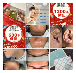 インスタグラム/脱毛サロン